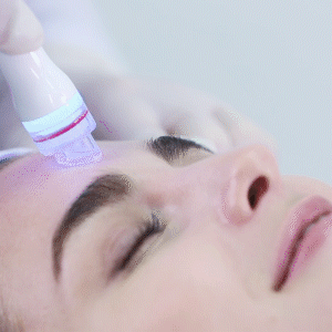Aquapure - Not just a hydra dermabrasion - this unique medical grade facial is a game changer