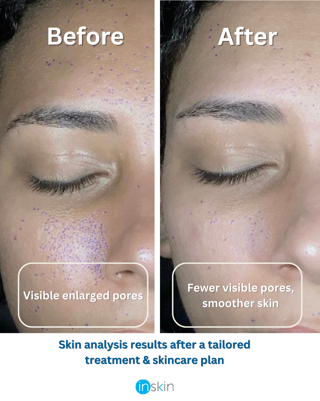 Have you ever wondered what your skin truly needs to be the best it can be?